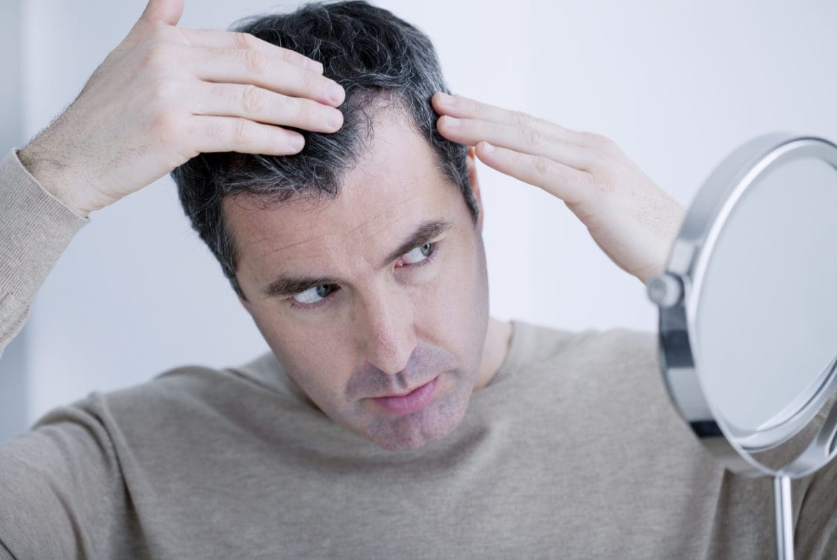 Covid-19 Increased risk of infection in men with baldness